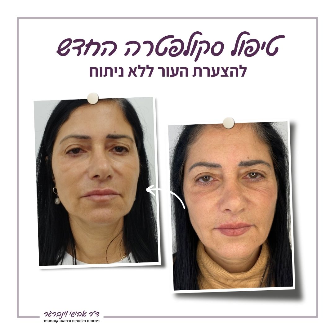 טיפול סקולפטרה - לפני אחרי